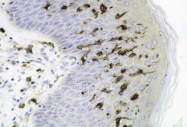 Dendritic_cells