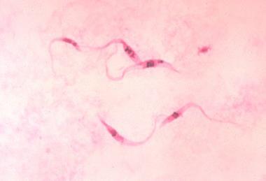 Trypanosoma_cruzi_crithidia