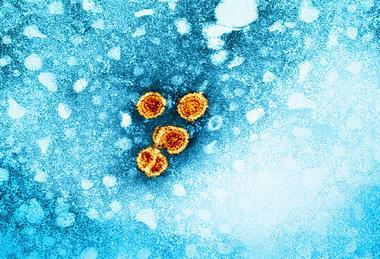 Hepatitis_B_Virus_(52443792486)