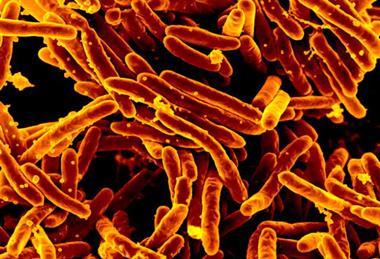 GD01 strain of Mycobacteroides abscessus isolated from patient