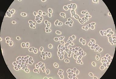 Saccharomyces_cerevisiae_100x_phase-contrast_microscopy2 (1)