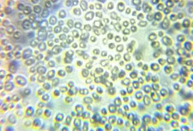 Microscope_view_of_Candida_albicans_34