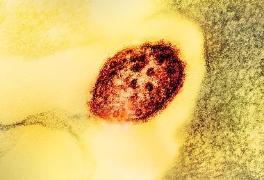 Measles_Virus_Particle (1)