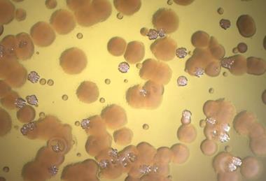 Low-Res_Pradeep Singh Micrograph 3
