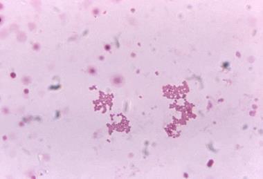 Veillonella_spp._under_1125X_magnification