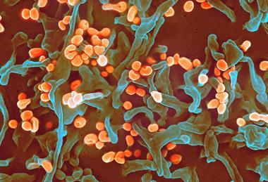 Lassa_virus_budding_off_a_Vero_cell