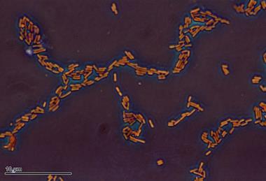 Escherichia_coli_(259_03)_Gramnegative_rods