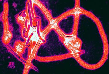 Ebola_virus_particles