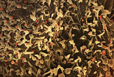national-institute-of-allergy-and-infectious-diseases-IC5S8EKtad0-unsplash