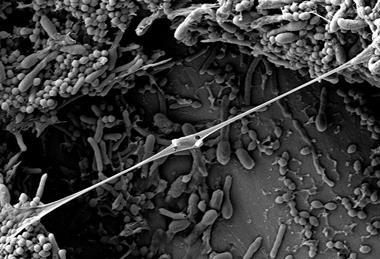 Mixed-culture biofilm