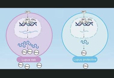 lupus
