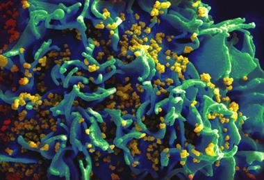 HIV-infected_H9_T_cell_(6813403685)