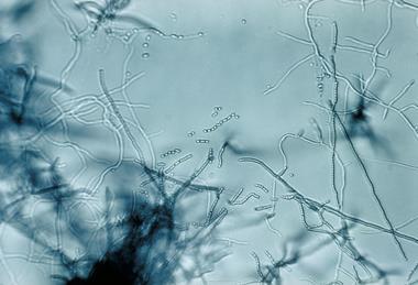 Streptomyces