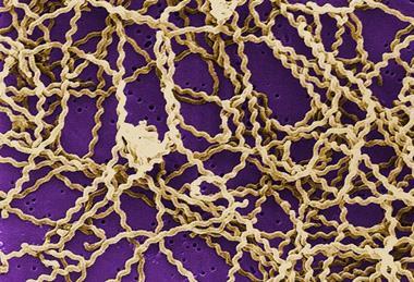 Leptospira_scanning_micrograph