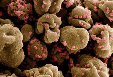 Novel_Coronavirus_SARS-CoV-2_-_53828235001