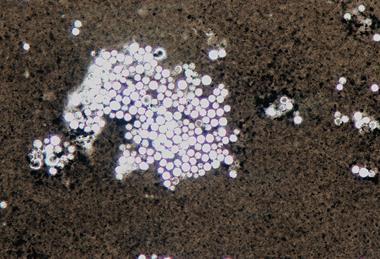 Cryptococcus_neoformans