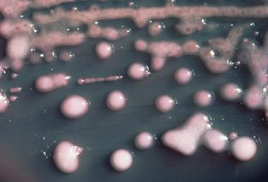 Klebsiella_pneumoniae_01