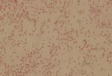 Gram_Negative_Rods_of_Aeromonas_hydrophila