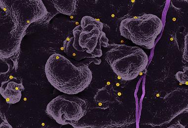 Crimean-Congo_Hemorrhagic_Fever_(CCHF)_Virus_(41541604722)