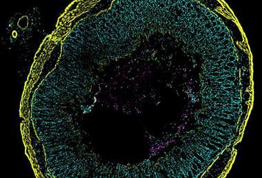 Low-Res_260305_Cdiffflourescentimage