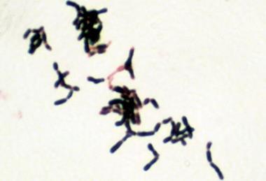 Bifidobacterium_adolescentis_Gram