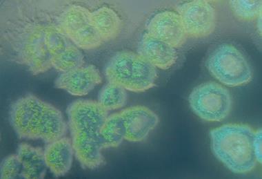 Pseudomonas_aeruginosa_on_cetrimide_agar (1)