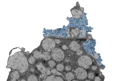 Low-Res_Human nasal epithelial cell releasing rhinovirus (blue) CREDIT Julien Amat & Bao Wang