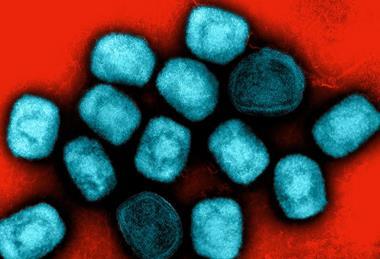 Mpox_Virus_Particles