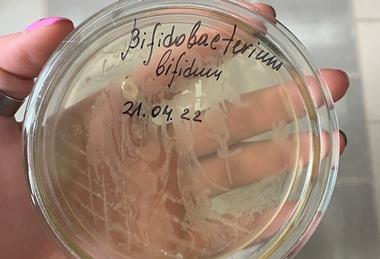 Bifidobacterium_bifidum,_рост_в_чашках