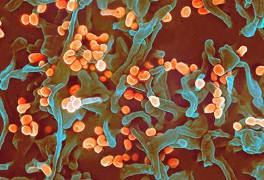 Lassa_virus_budding_off_a_Vero_cell