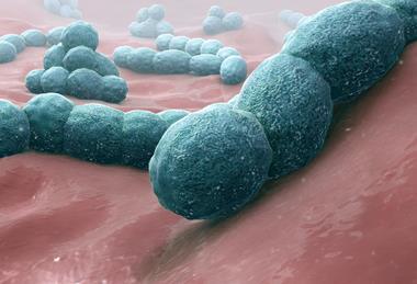 Streptococcus_pneumoniae_-_A_causative_bacteria_of_meningitis