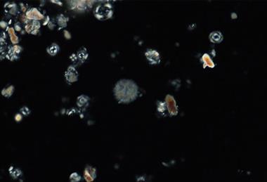 Low-Res_Pic2_nannofossils