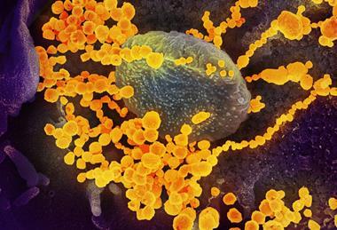 SARS-CoV-2_scanning_electron_microscope_image (1)