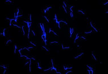 Low-Res_Borrelia_recurrentis_c_Flavia_Reyer_unimedizin-ffm