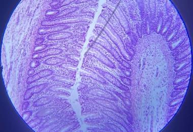 Толстая_кишка