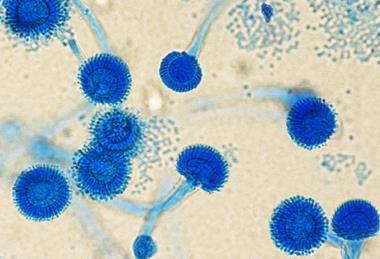 Antonio_e_Biagio_e_Cesare_Arrigo_Aspergillus_fumigatus_01