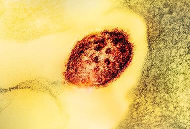 Measles_Virus_Particle (2)