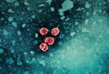 Hepatitis_B_Virus_(52444068579)