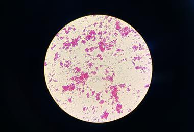 Nontuberculous_Mycobacteria_(NTM)_in_Ziehl-Neelsen_Staining_from_Positive_MGIT_Culture