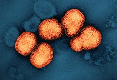 Influenza_A_Virus_(H3N2)_(52747106987)