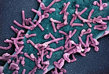 Marburg_virus_outbreak