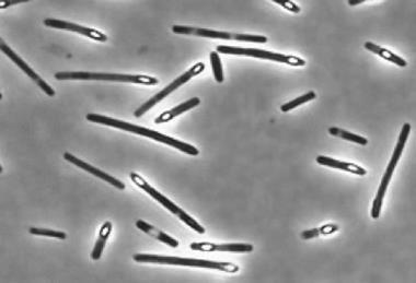 Clostridium_perfringens_sporulating