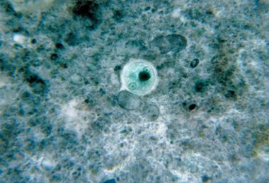 Entamoeba_histolytica_01