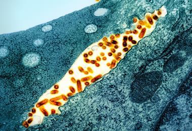Vesicular_Stomatitis_Virus_(VSV)_particles_(orange)_found_in_extracellular_space_and_budding_from_the_plasma_membrane_of_infected_cells_(teal)