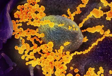 SARS-CoV-2_scanning_electron_microscope_image