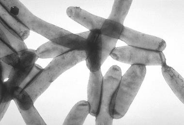 Legionella_pneumophila_01