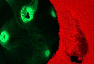Low-Res_Black Band Disease under the fluorescence microscope_Credit_D’Angelo and Wiedenmann_University of Southampton