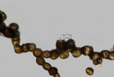 Low-Res_melanized hyphae developing into chlamydospores(1)