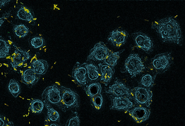 Lung_cells_infection_by_Pseudomonas_aeruginosa.tif