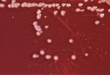 Pseudomonas_aeruginosa_01